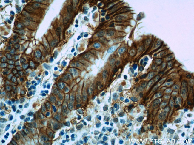 VSIG1 Antibody in Immunohistochemistry (Paraffin) (IHC (P))