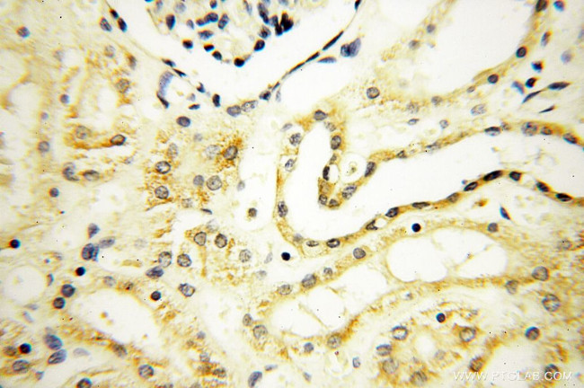 VSIG1 Antibody in Immunohistochemistry (Paraffin) (IHC (P))