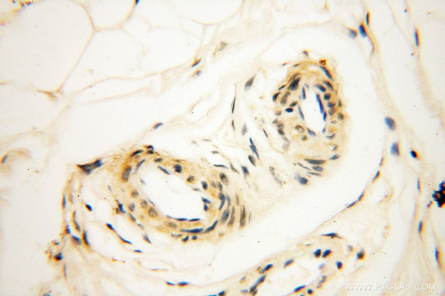 VSIG1 Antibody in Immunohistochemistry (Paraffin) (IHC (P))