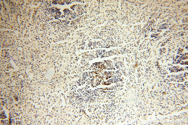 VSIG1 Antibody in Immunohistochemistry (Paraffin) (IHC (P))