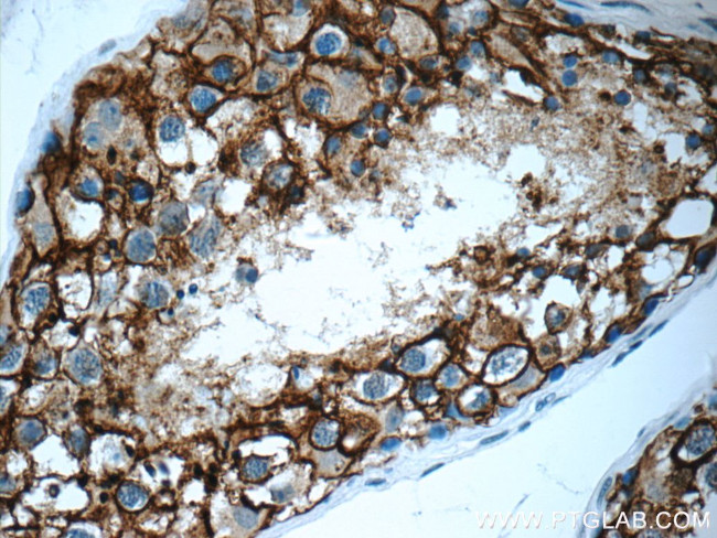 VSIG1 Antibody in Immunohistochemistry (Paraffin) (IHC (P))