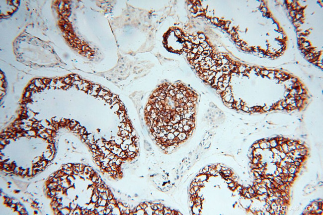 VSIG1 Antibody in Immunohistochemistry (Paraffin) (IHC (P))