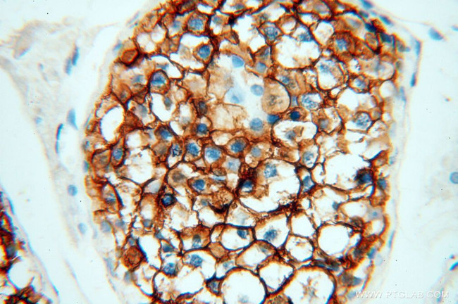 VSIG1 Antibody in Immunohistochemistry (Paraffin) (IHC (P))