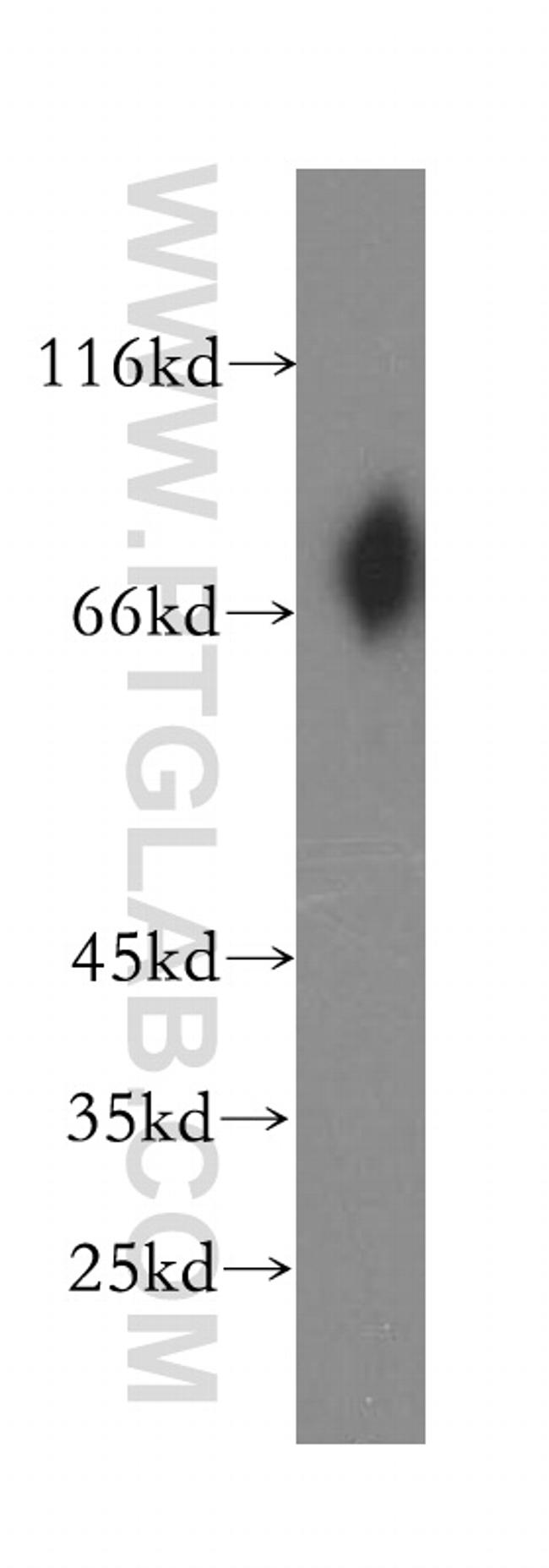 VSIG1 Antibody in Western Blot (WB)