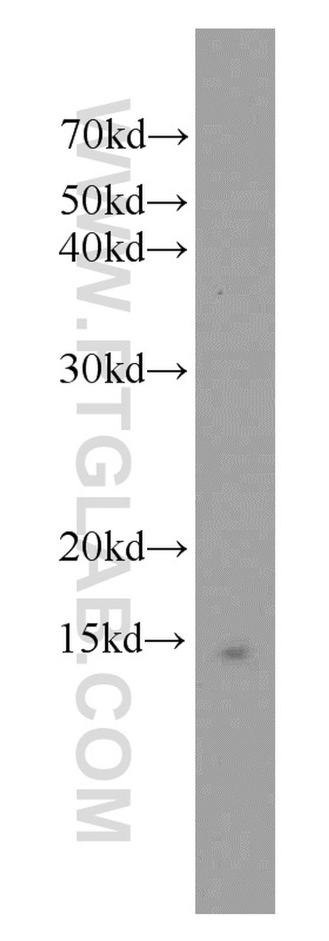 FXN Antibody in Western Blot (WB)