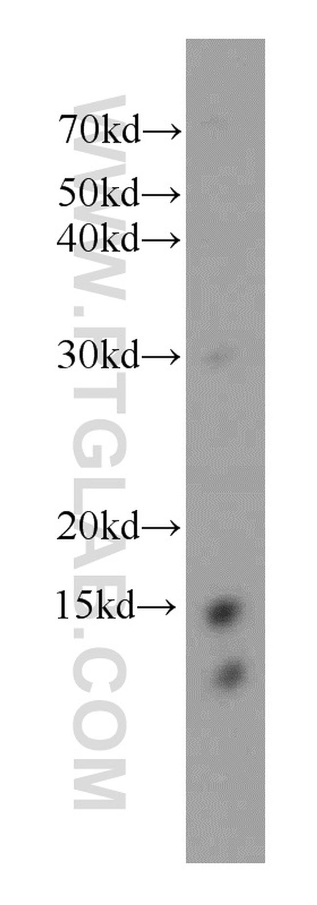 FXN Antibody in Western Blot (WB)