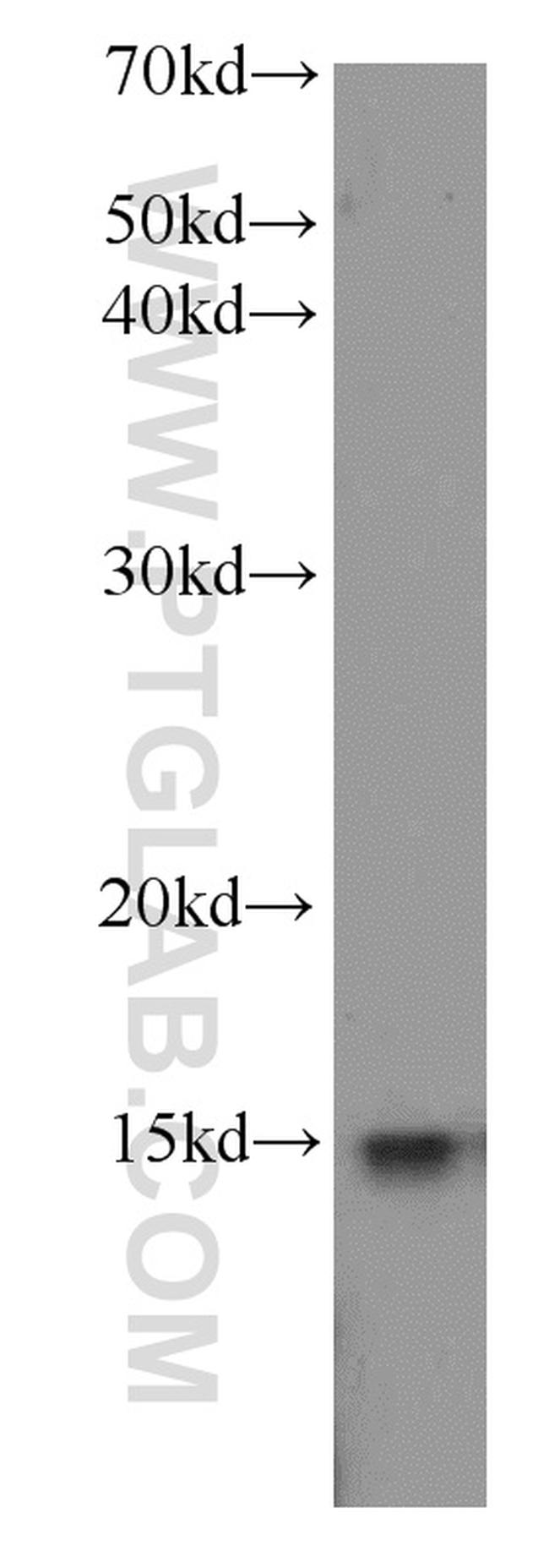 FXN Antibody in Western Blot (WB)