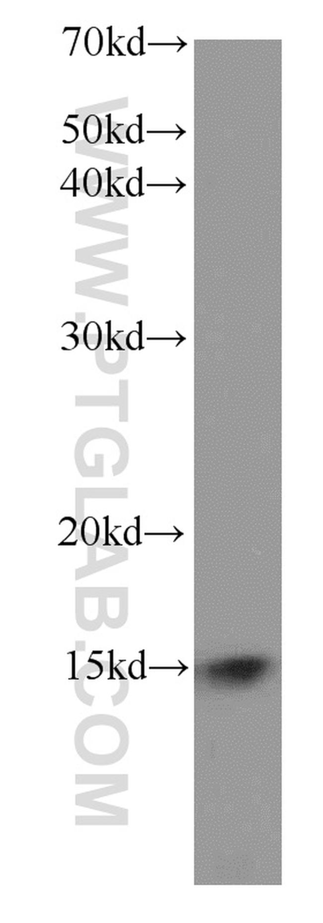 FXN Antibody in Western Blot (WB)