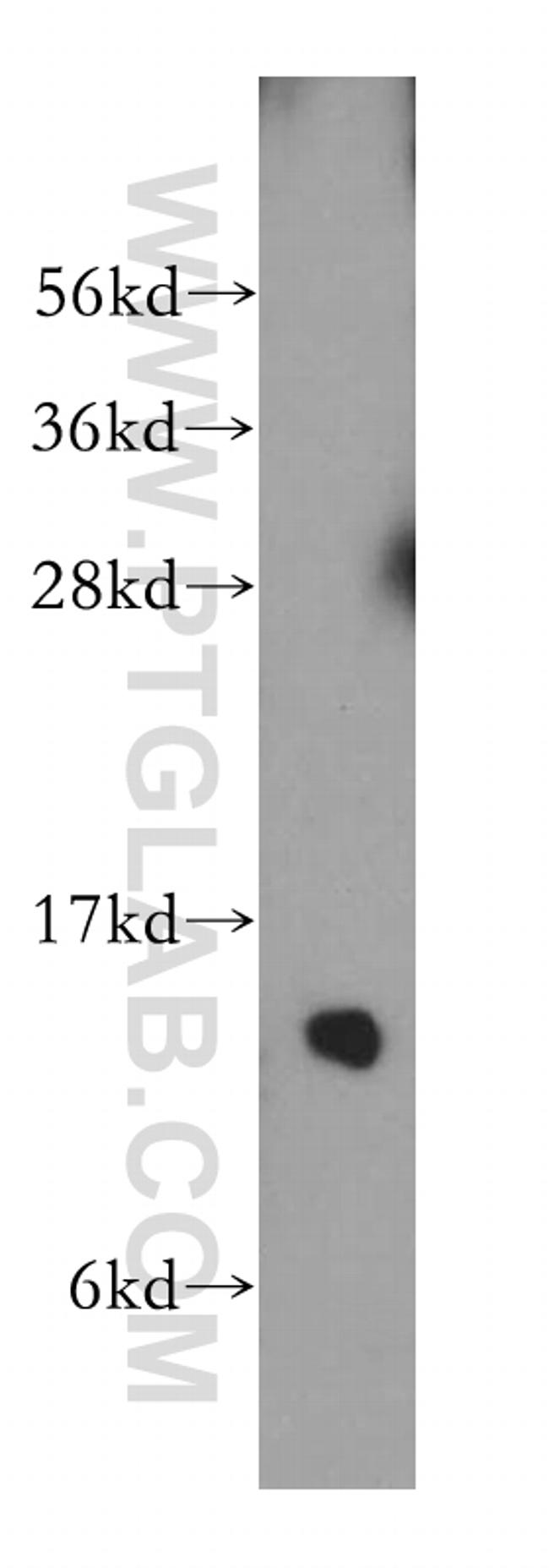 FXN Antibody in Western Blot (WB)