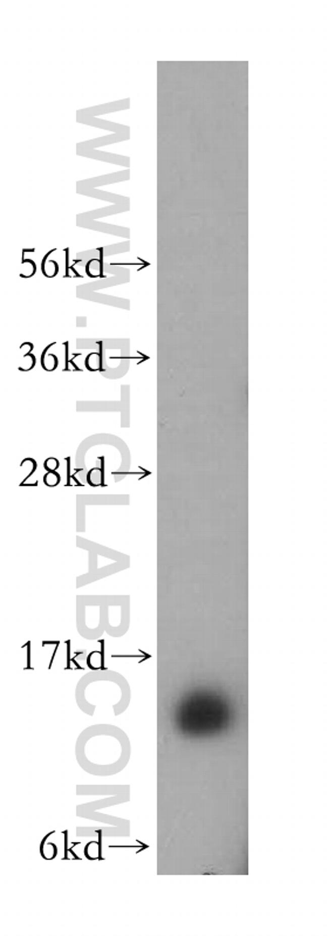 FXN Antibody in Western Blot (WB)