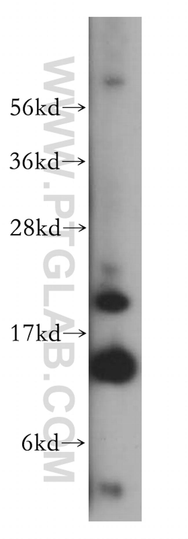 FXN Antibody in Western Blot (WB)