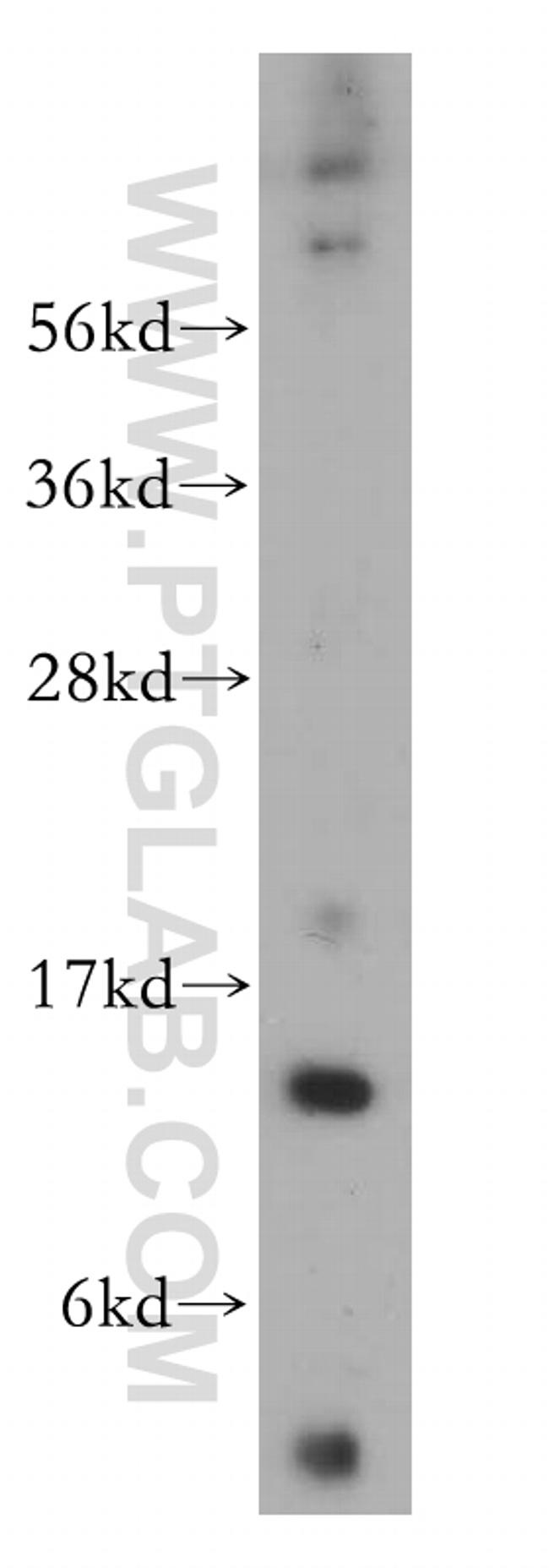 FXN Antibody in Western Blot (WB)