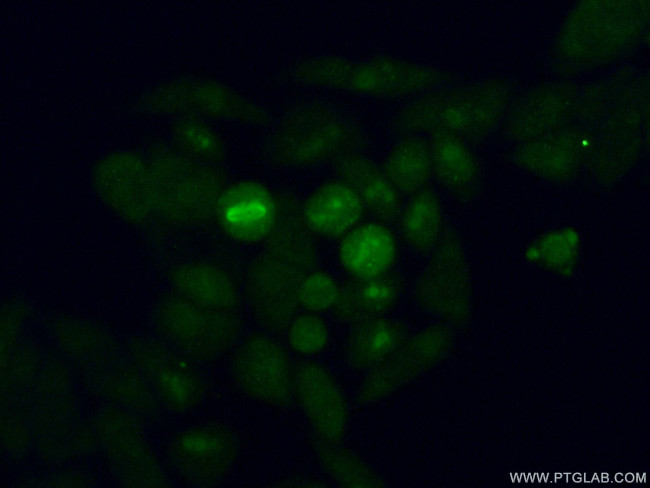 ABT1 Antibody in Immunocytochemistry (ICC/IF)