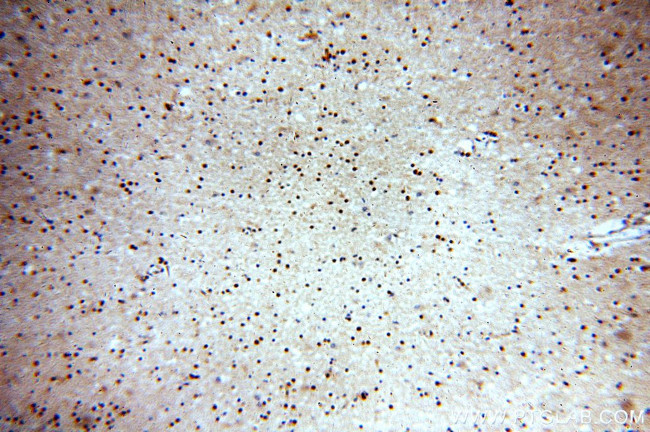 ABT1 Antibody in Immunohistochemistry (Paraffin) (IHC (P))