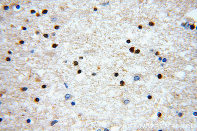 ABT1 Antibody in Immunohistochemistry (Paraffin) (IHC (P))