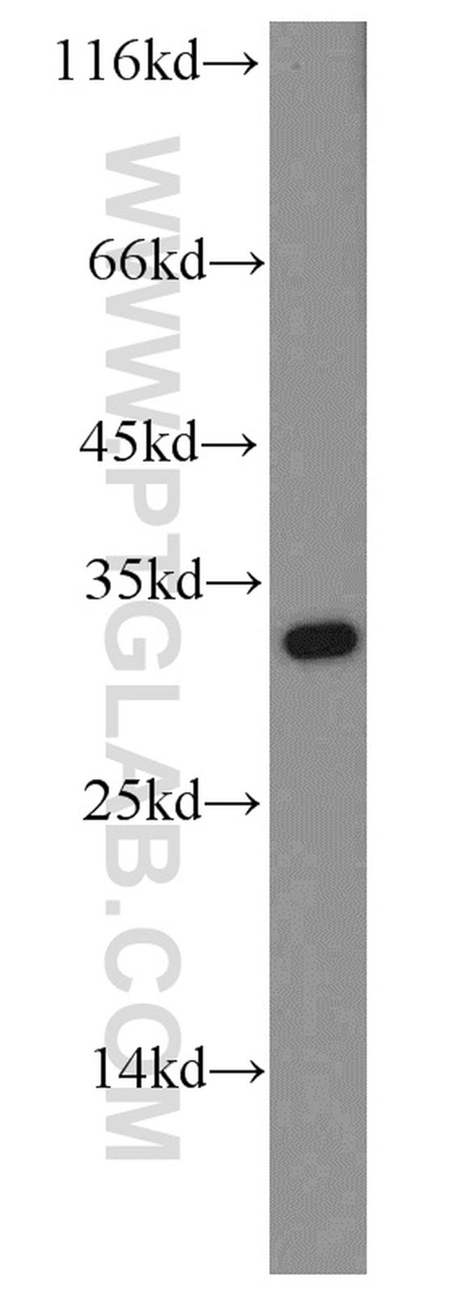 ABT1 Antibody in Western Blot (WB)