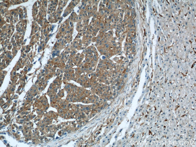 RP2 Antibody in Immunohistochemistry (Paraffin) (IHC (P))