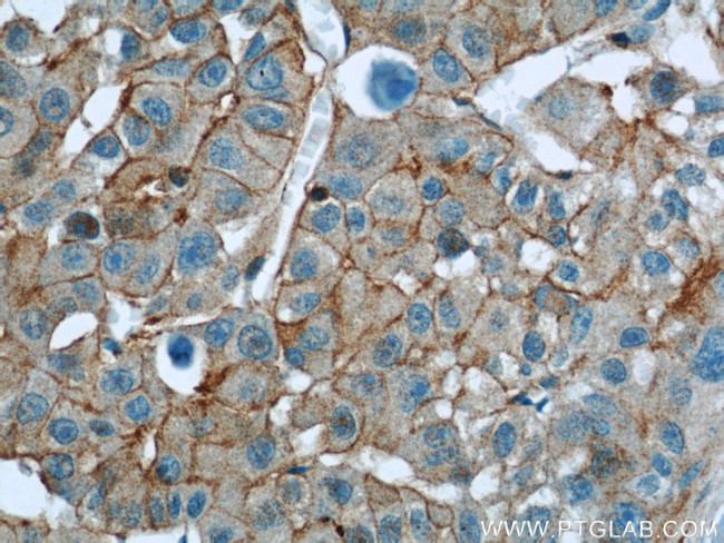 RP2 Antibody in Immunohistochemistry (Paraffin) (IHC (P))