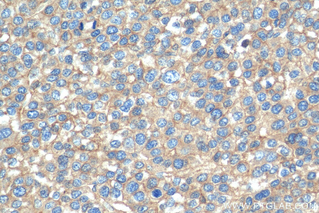 RP2 Antibody in Immunohistochemistry (Paraffin) (IHC (P))