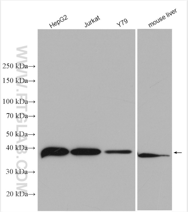 RP2 Antibody in Western Blot (WB)