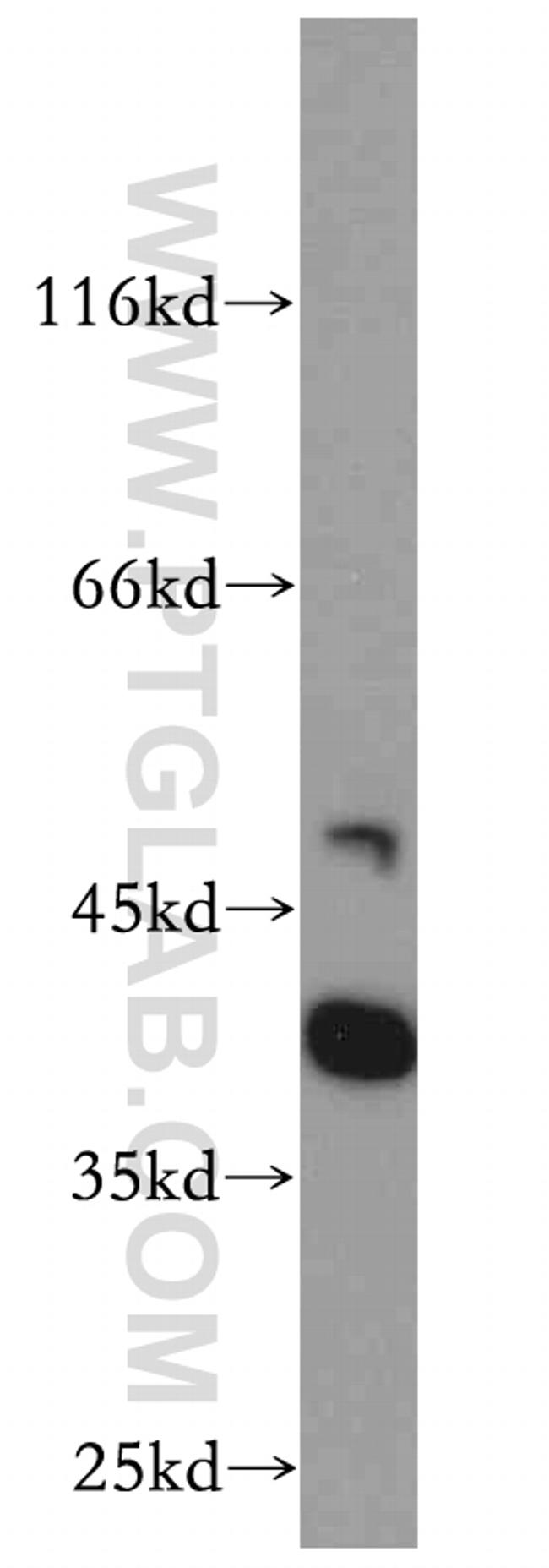 RP2 Antibody in Western Blot (WB)