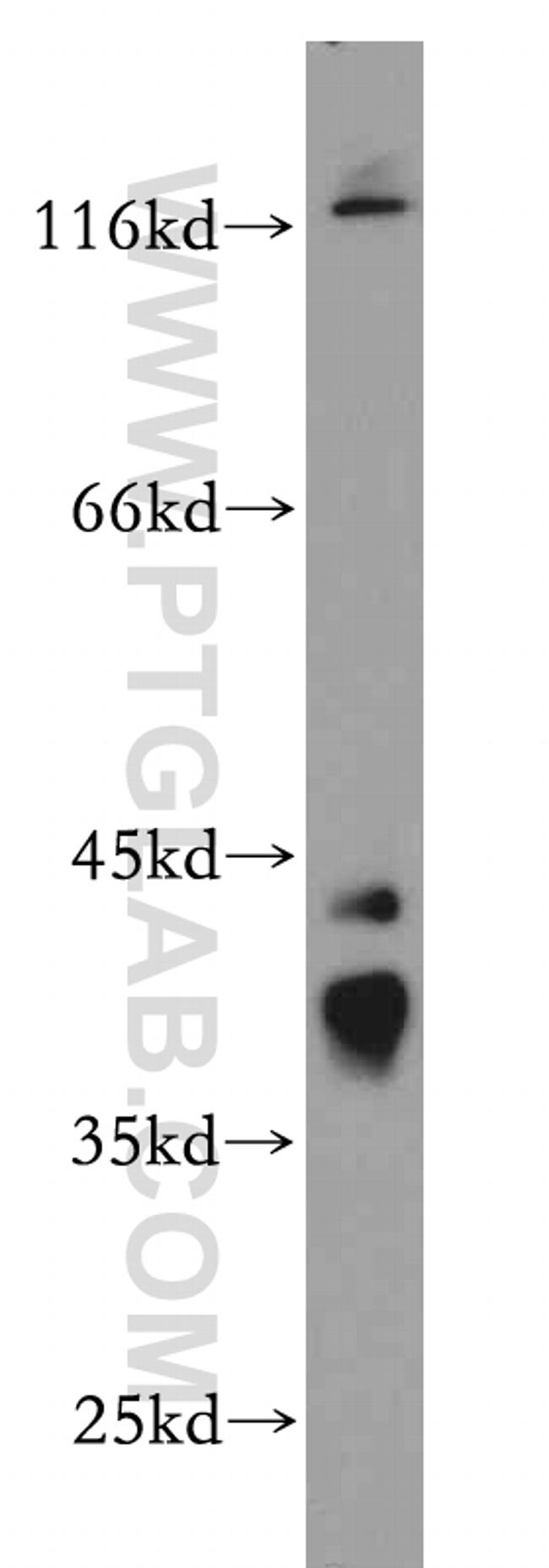 RP2 Antibody in Western Blot (WB)