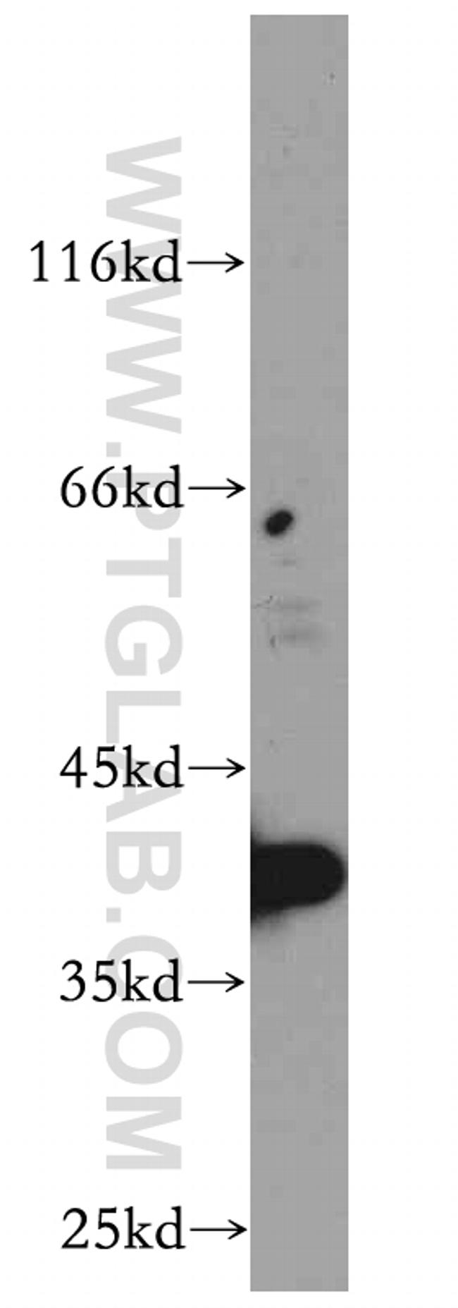 RP2 Antibody in Western Blot (WB)