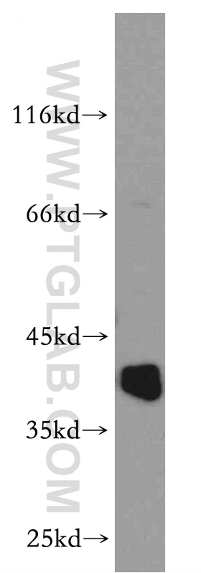 RP2 Antibody in Western Blot (WB)