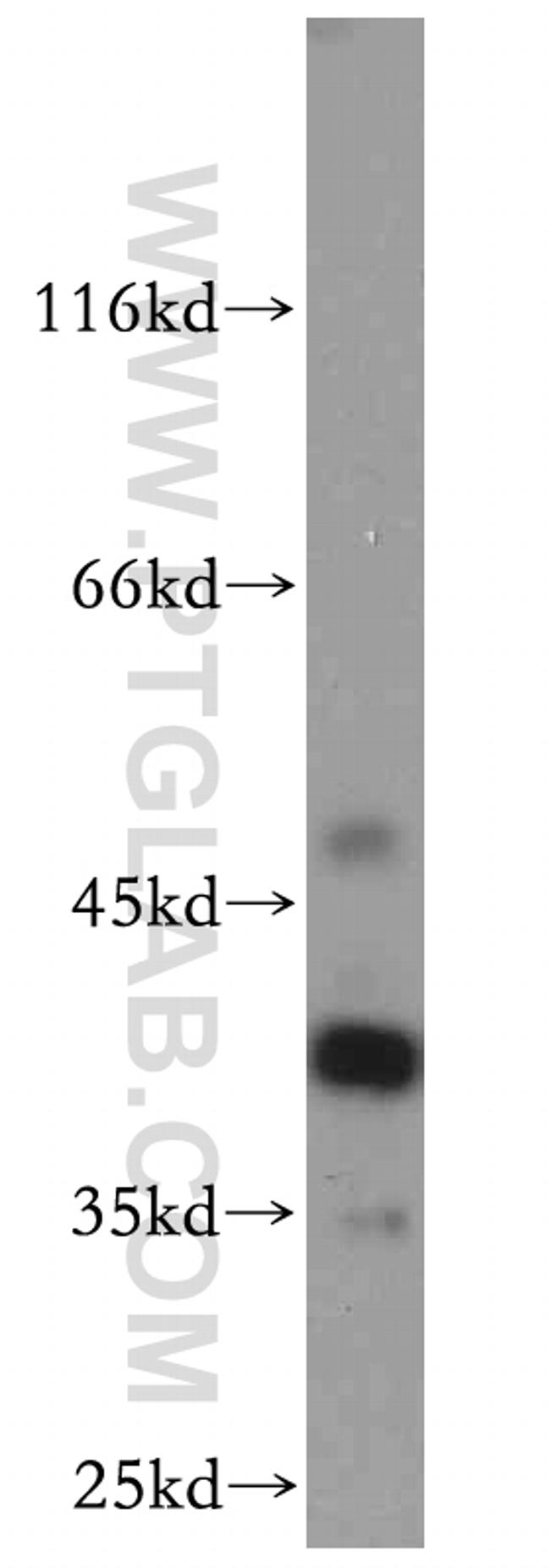 RP2 Antibody in Western Blot (WB)