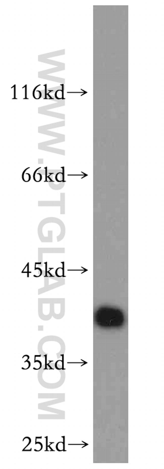 RP2 Antibody in Western Blot (WB)