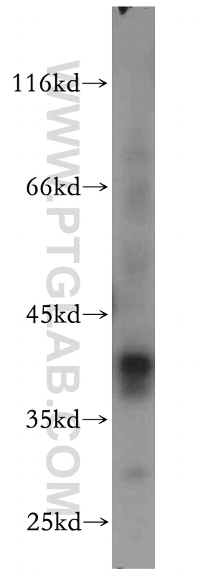 RP2 Antibody in Western Blot (WB)