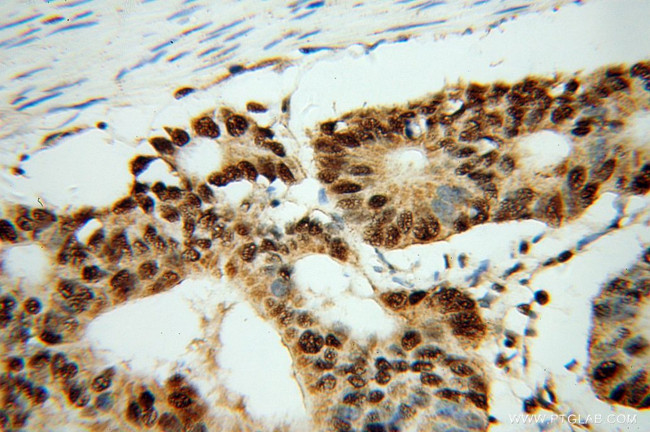 FKBP5 Antibody in Immunohistochemistry (Paraffin) (IHC (P))