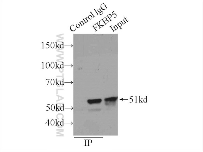 FKBP5 Antibody in Immunoprecipitation (IP)