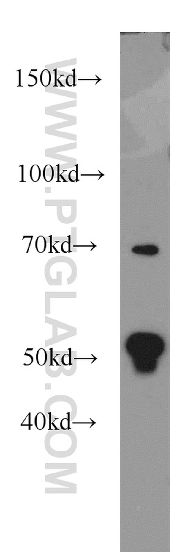 FKBP5 Antibody in Western Blot (WB)