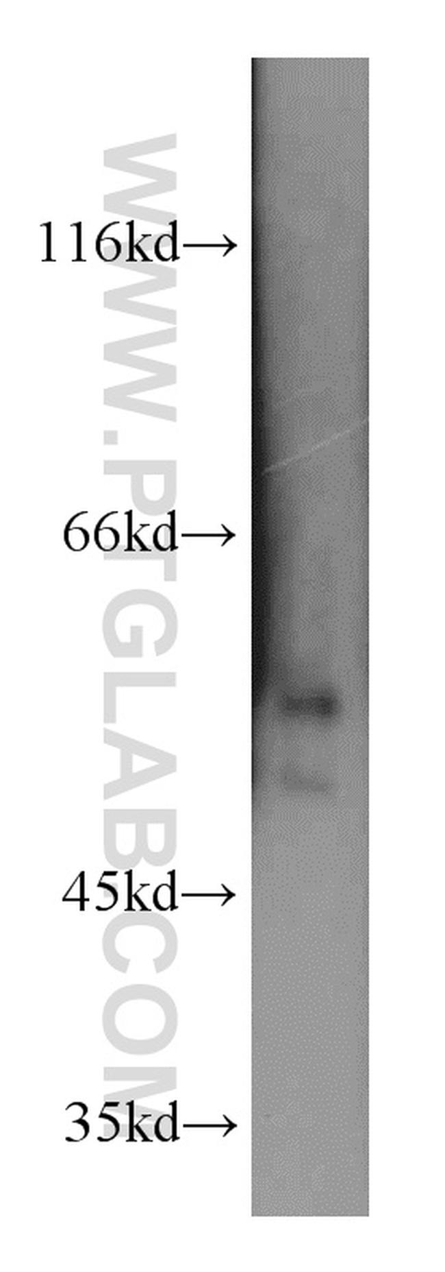 FKBP5 Antibody in Western Blot (WB)