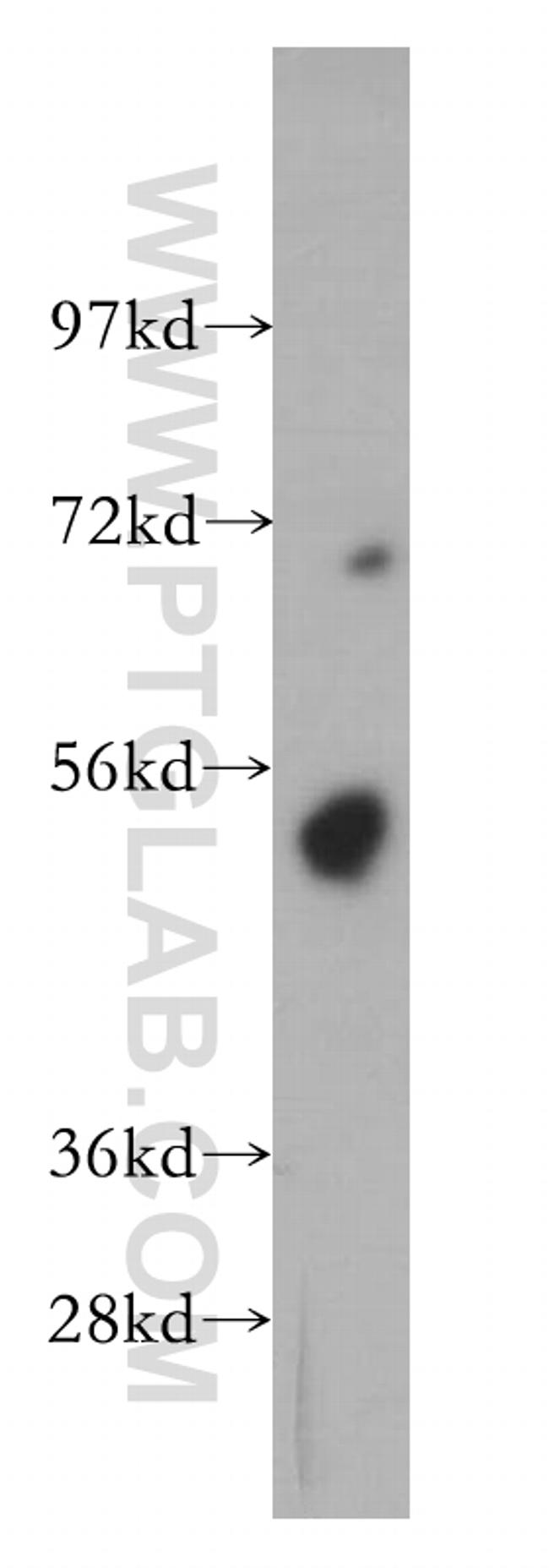 FKBP5 Antibody in Western Blot (WB)