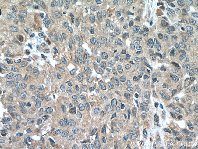 EBF1 Antibody in Immunohistochemistry (Paraffin) (IHC (P))