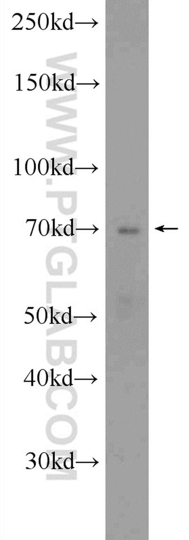 EBF1 Antibody in Western Blot (WB)