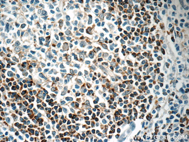 HVCN1 Antibody in Immunohistochemistry (Paraffin) (IHC (P))