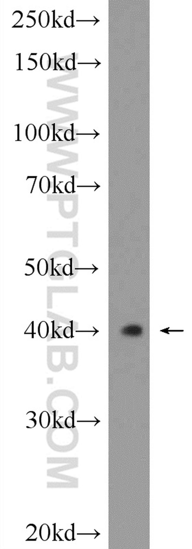 HVCN1 Antibody in Western Blot (WB)