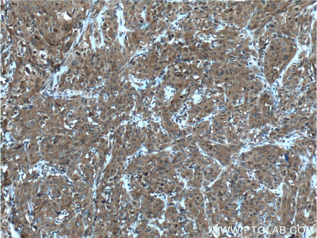 IRF9 Antibody in Immunohistochemistry (Paraffin) (IHC (P))