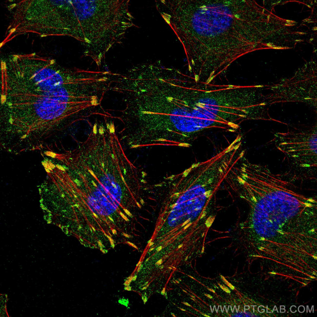 Talin-1 Antibody in Immunocytochemistry (ICC/IF)