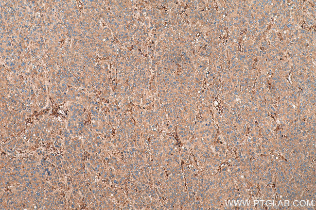 Talin-1 Antibody in Immunohistochemistry (Paraffin) (IHC (P))