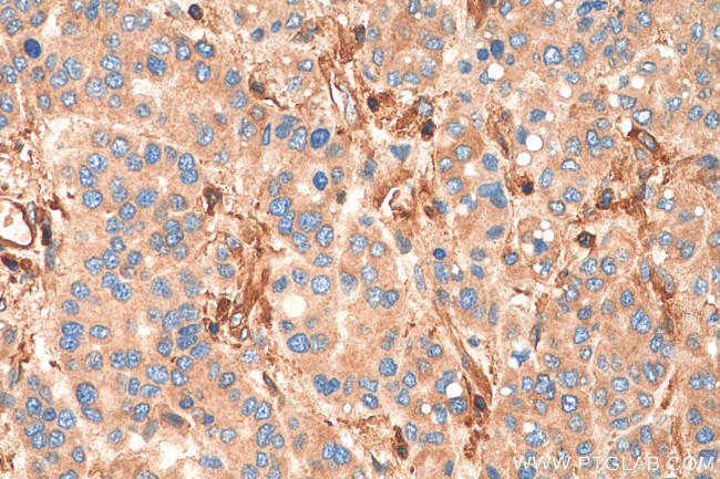 Talin-1 Antibody in Immunohistochemistry (Paraffin) (IHC (P))