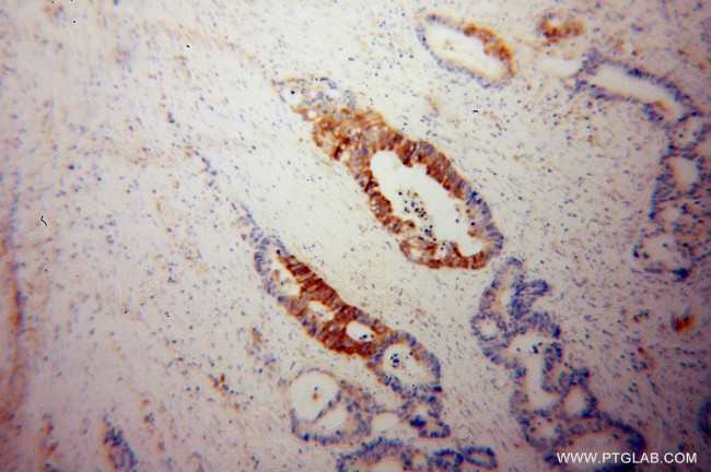 Talin-1 Antibody in Immunohistochemistry (Paraffin) (IHC (P))