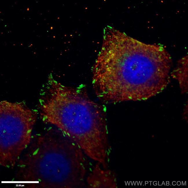 Talin-1 Antibody in Immunocytochemistry (ICC/IF)