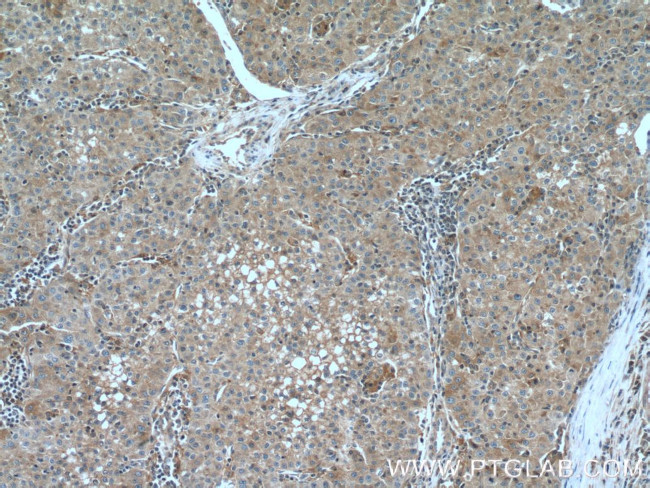 Talin-1 Antibody in Immunohistochemistry (Paraffin) (IHC (P))