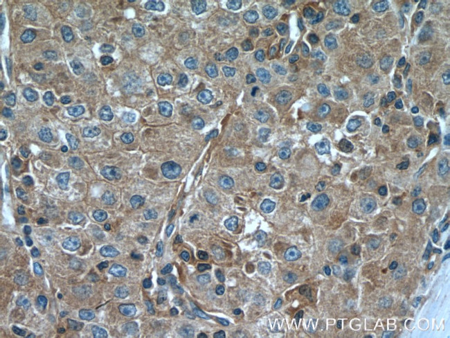 Talin-1 Antibody in Immunohistochemistry (Paraffin) (IHC (P))