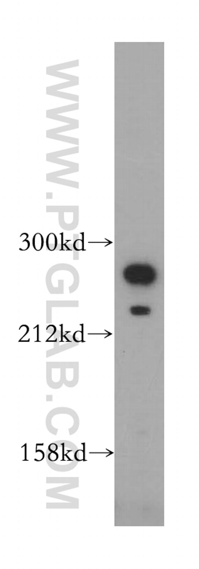 Talin-1 Antibody in Western Blot (WB)