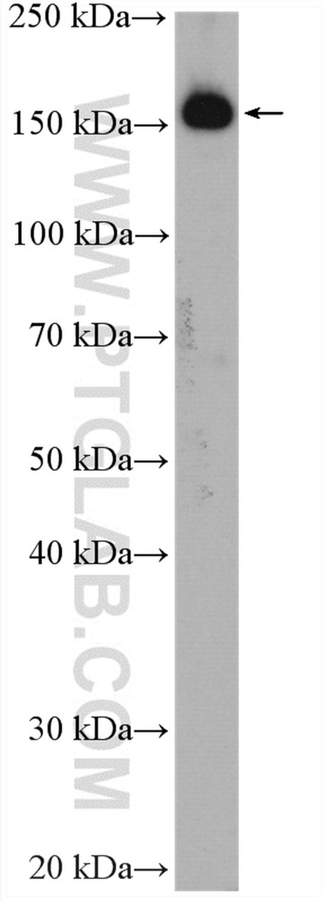 UGCGL1 Antibody in Western Blot (WB)